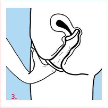Femidom 3pc Female Condoms