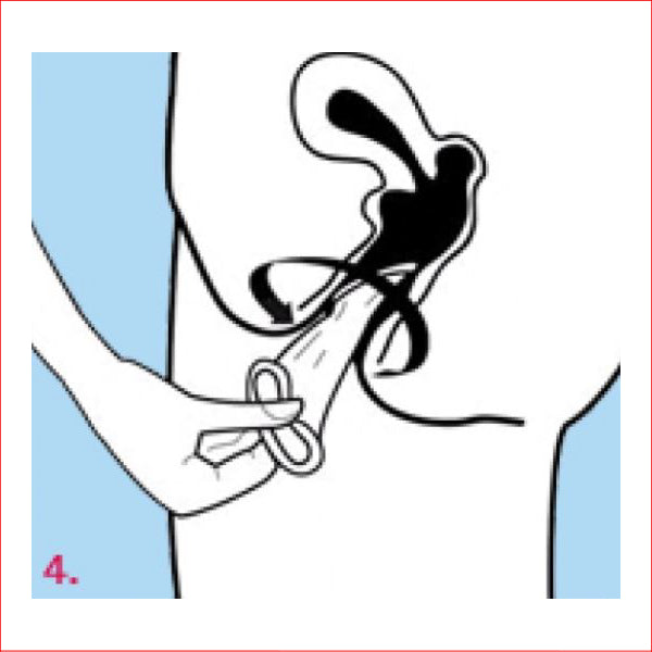 Femidom 3pc Female Condoms